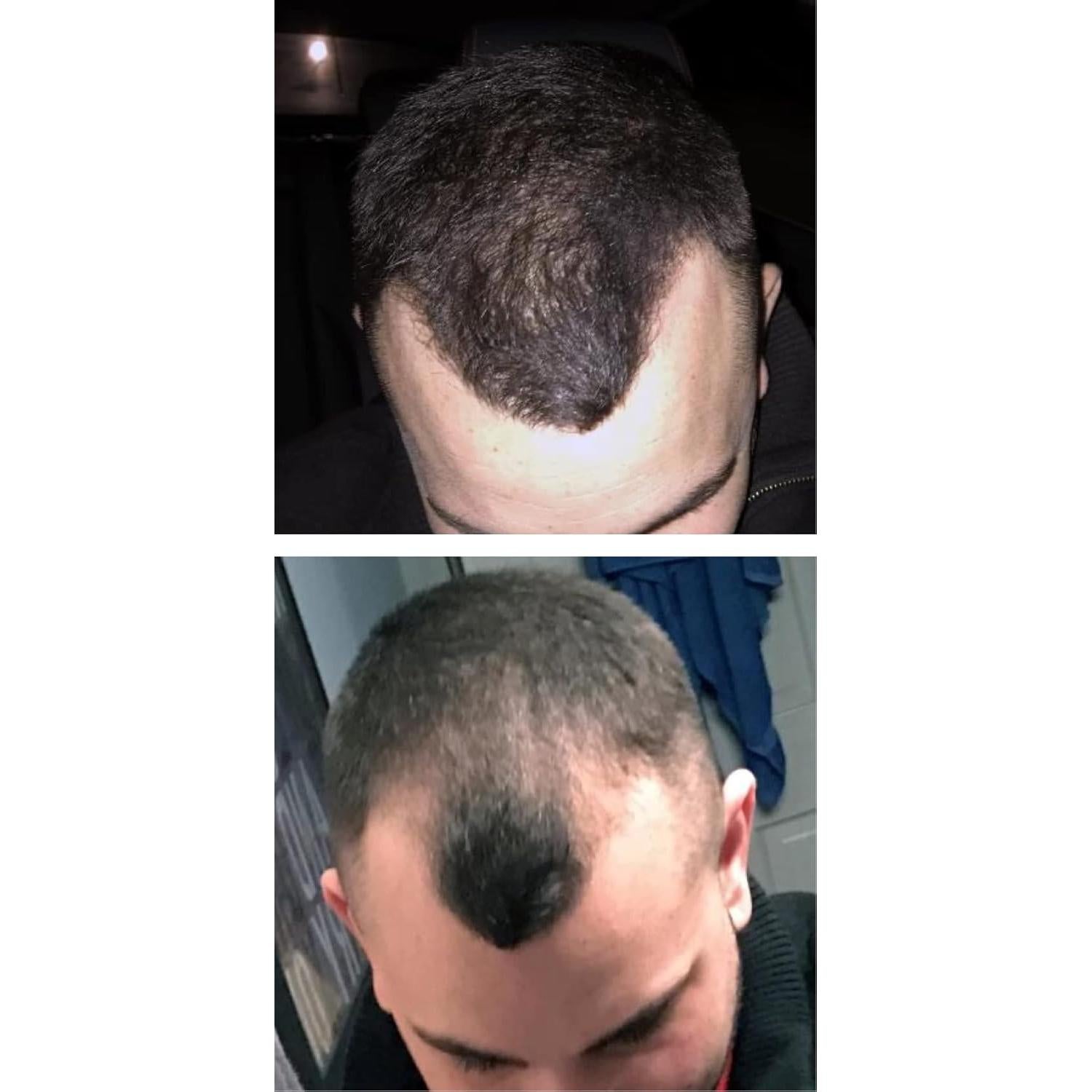 Fibra de Cabello Natural Caboki 3x30g Marrón Oscuro - 270 Días