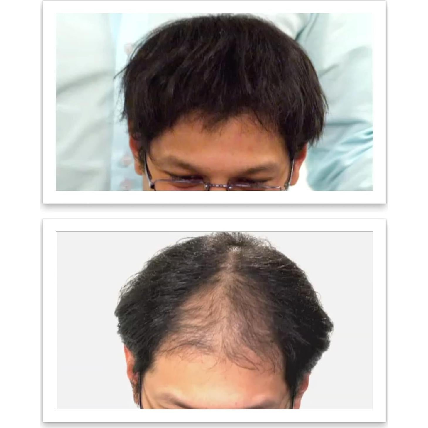 Fibra de Cabello Natural Caboki 3x30g Marrón Oscuro - 270 Días