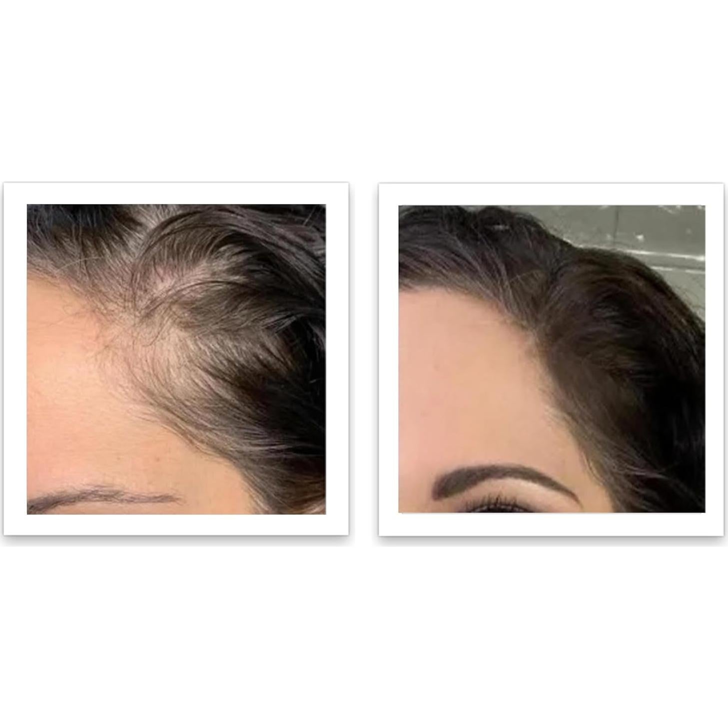 Caboki Voluminizador de Cabello Marrón Medio 45g - Libre de Talco