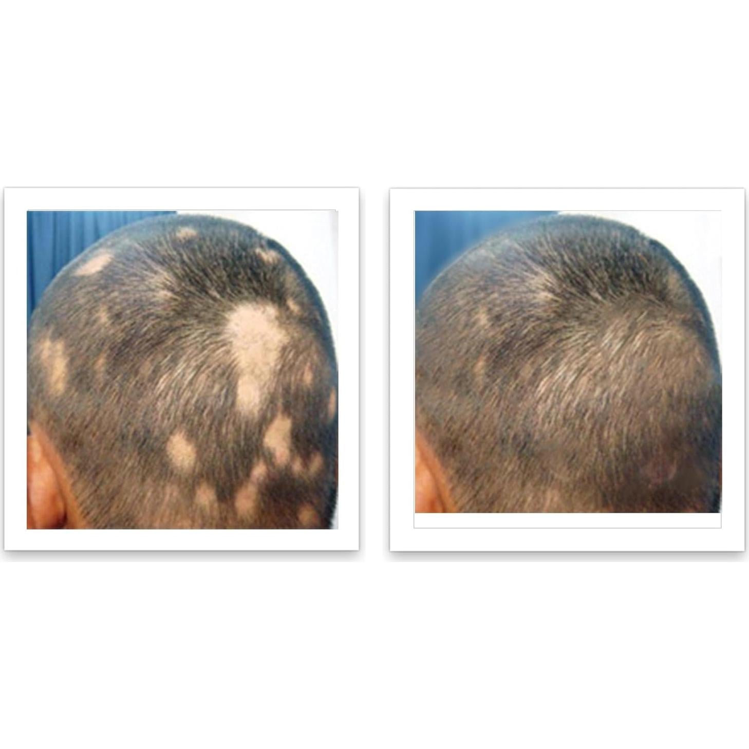 Caboki Voluminizador de Cabello Marrón Medio 45g - Libre de Talco