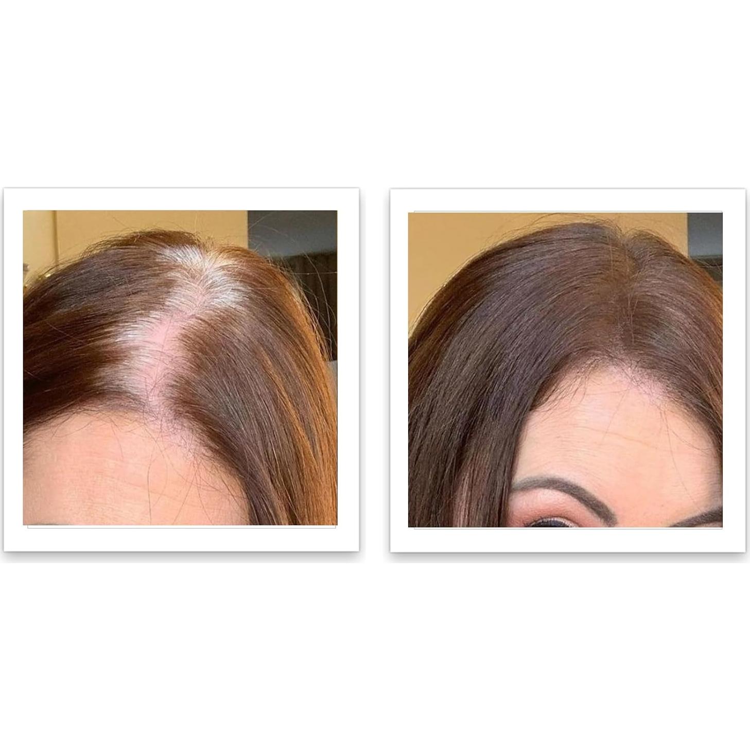 Caboki Voluminizador de Cabello Marrón Medio 45g - Libre de Talco