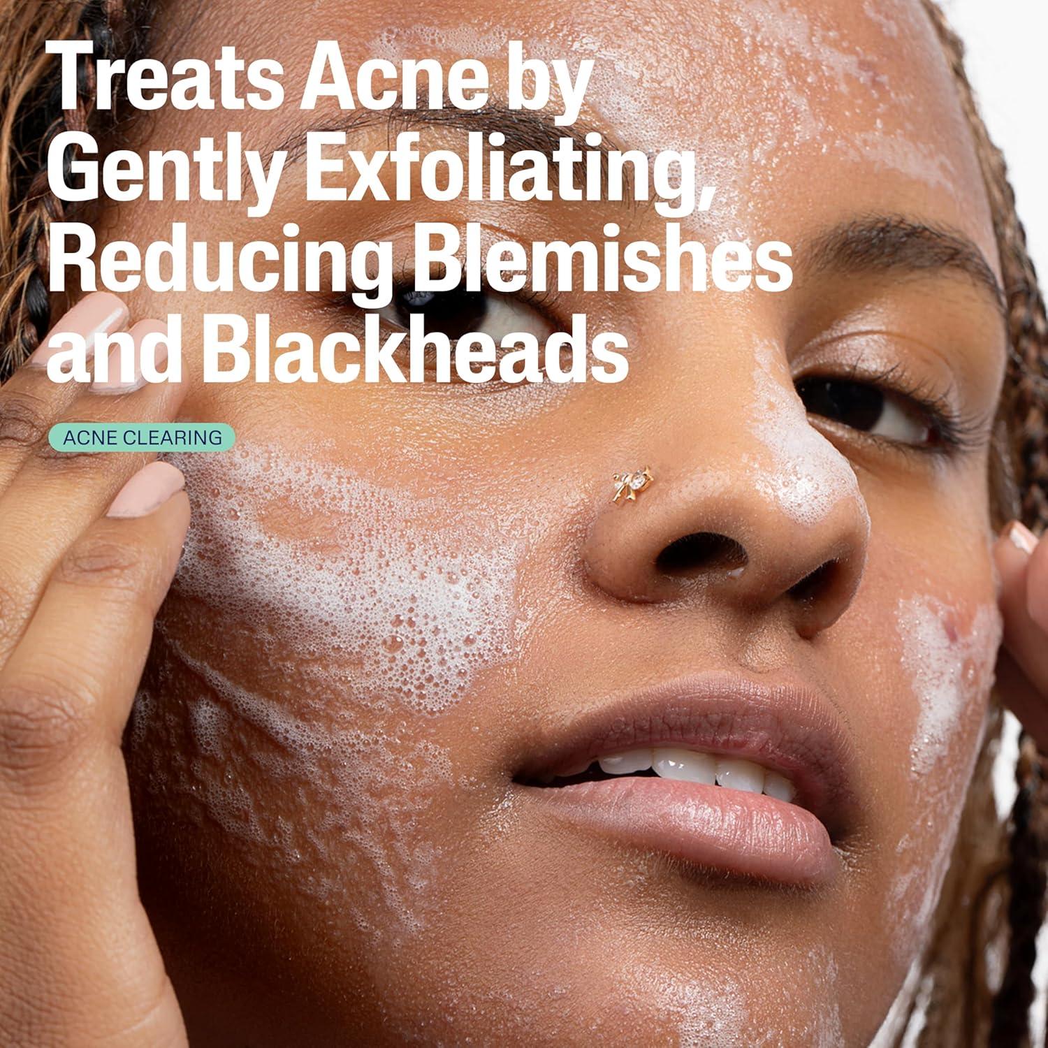 Cetaphil Limpiador de Acné Suave 236 ml con 2% Ácido Salicílico