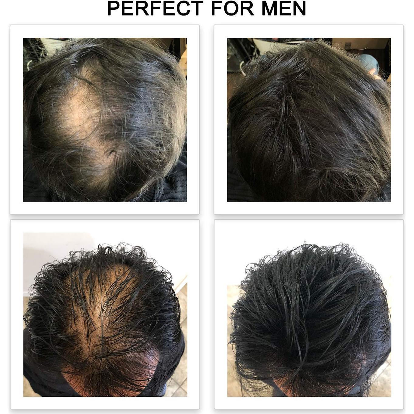 Fibras para Cabello FEBRON 30g Gris Oscuro - Voluminizador Natural