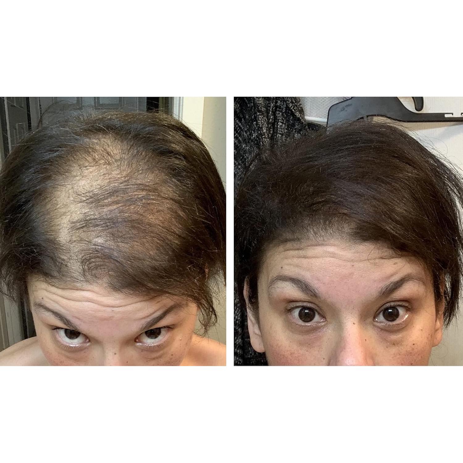 Fibra para Cabello Caboki 16g Marrón Oscuro - Natural y Resistente