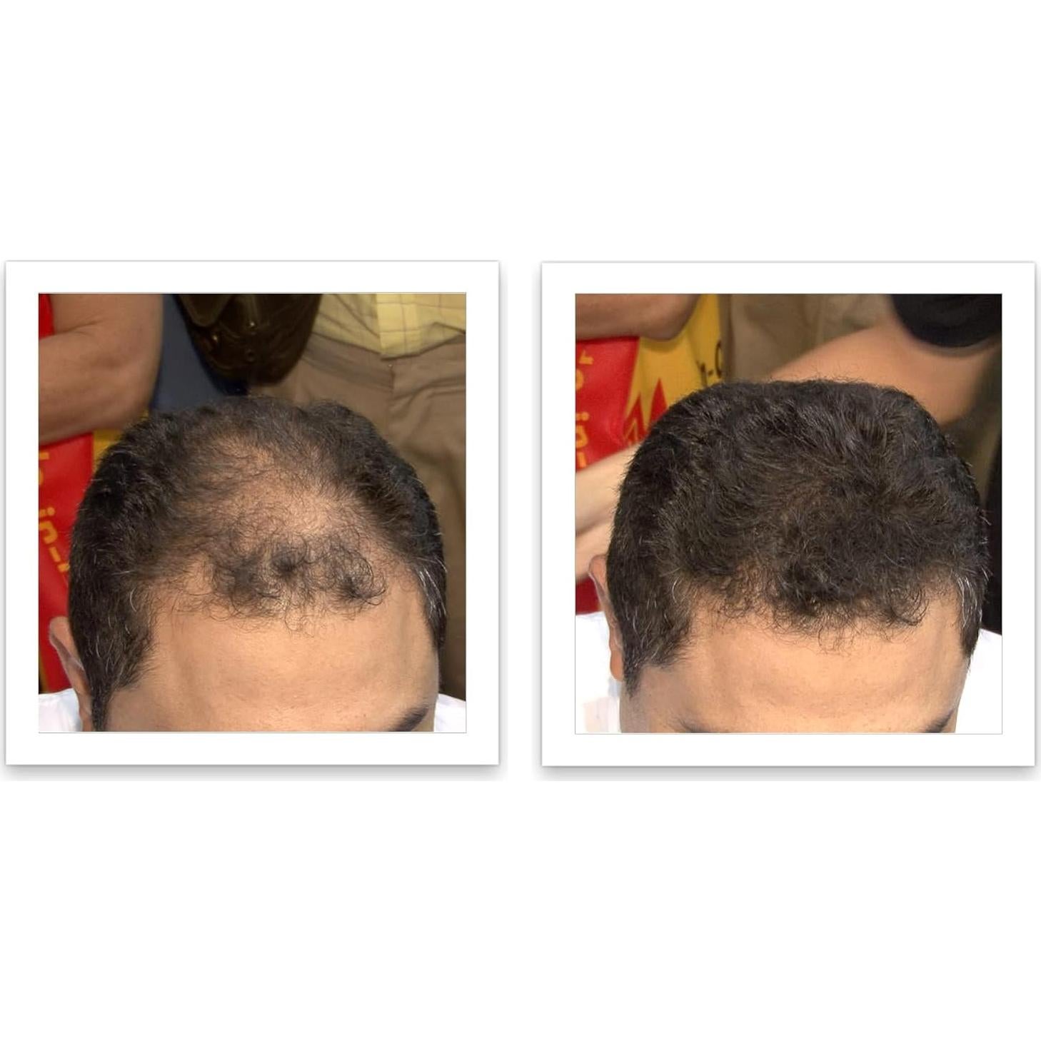 Fibra para Cabello Caboki 16g Marrón Oscuro - Natural y Resistente