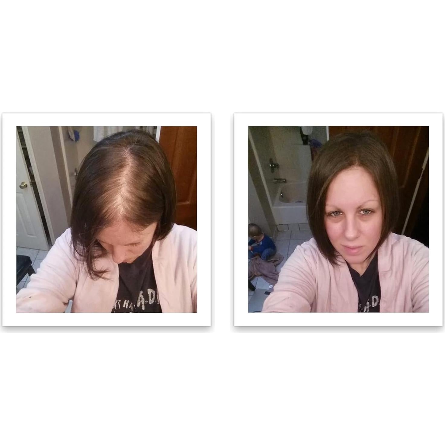 Fibra para Cabello Caboki 16g Marrón Oscuro - Natural y Resistente