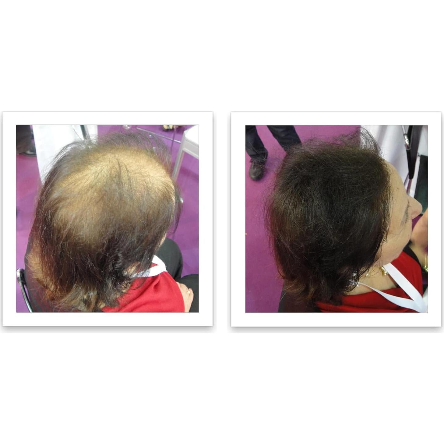 Fibra para Cabello Caboki 16g Marrón Oscuro - Natural y Resistente