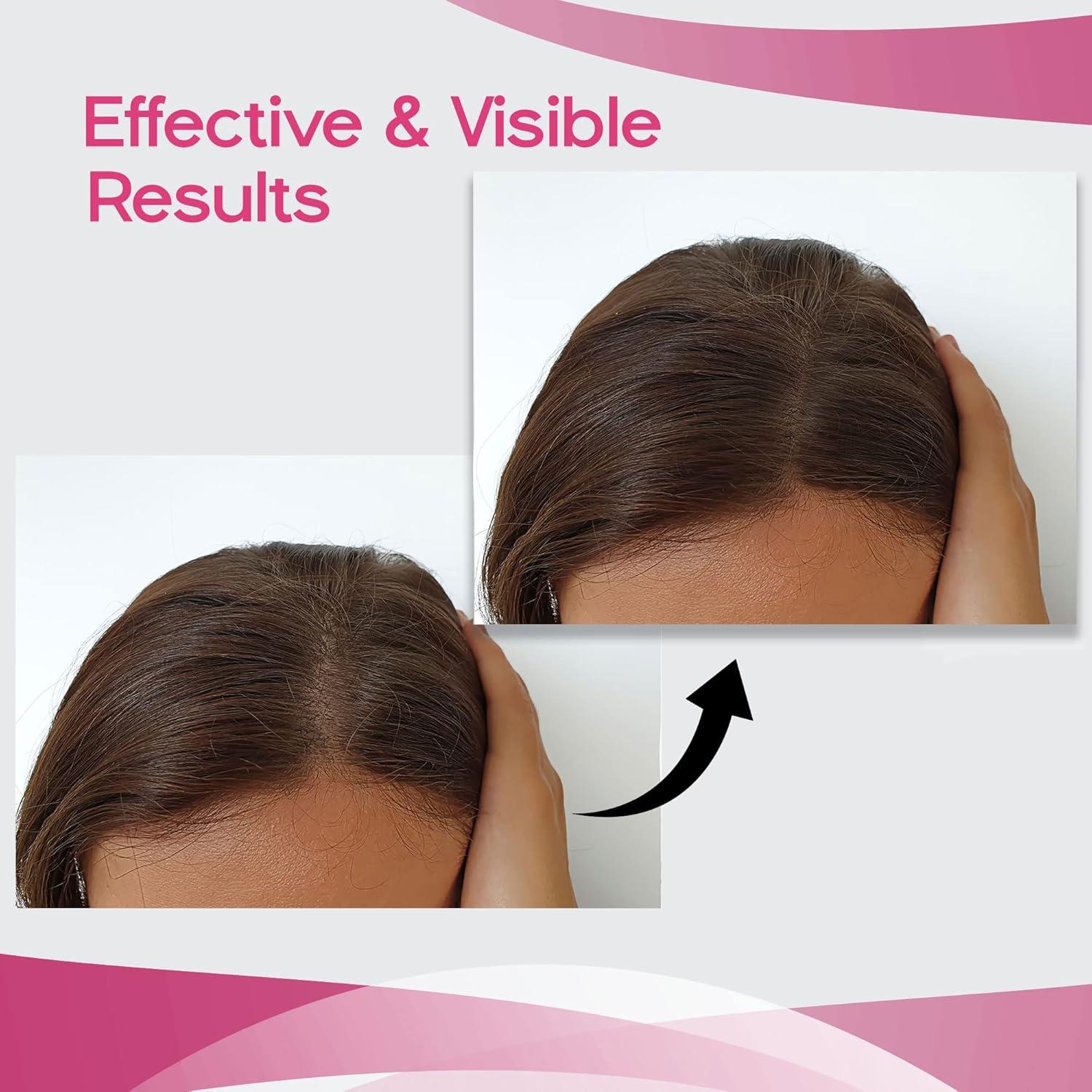 Cepillo Desenredante Herstyler Rosa para Cabello Grueso 27.7cm