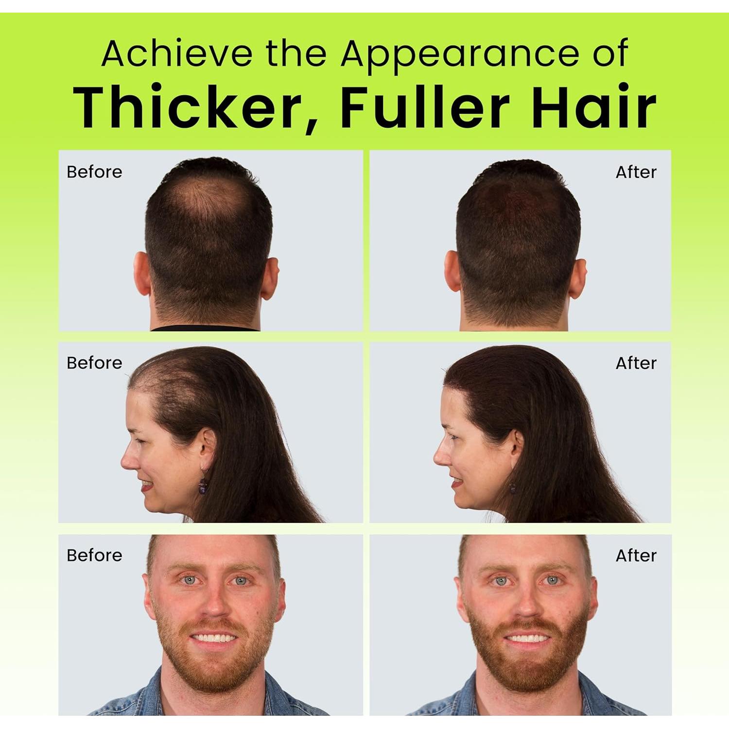 Fibras para Cabello ECLIPSE Marrón Medio 15g - Oculta Pérdida