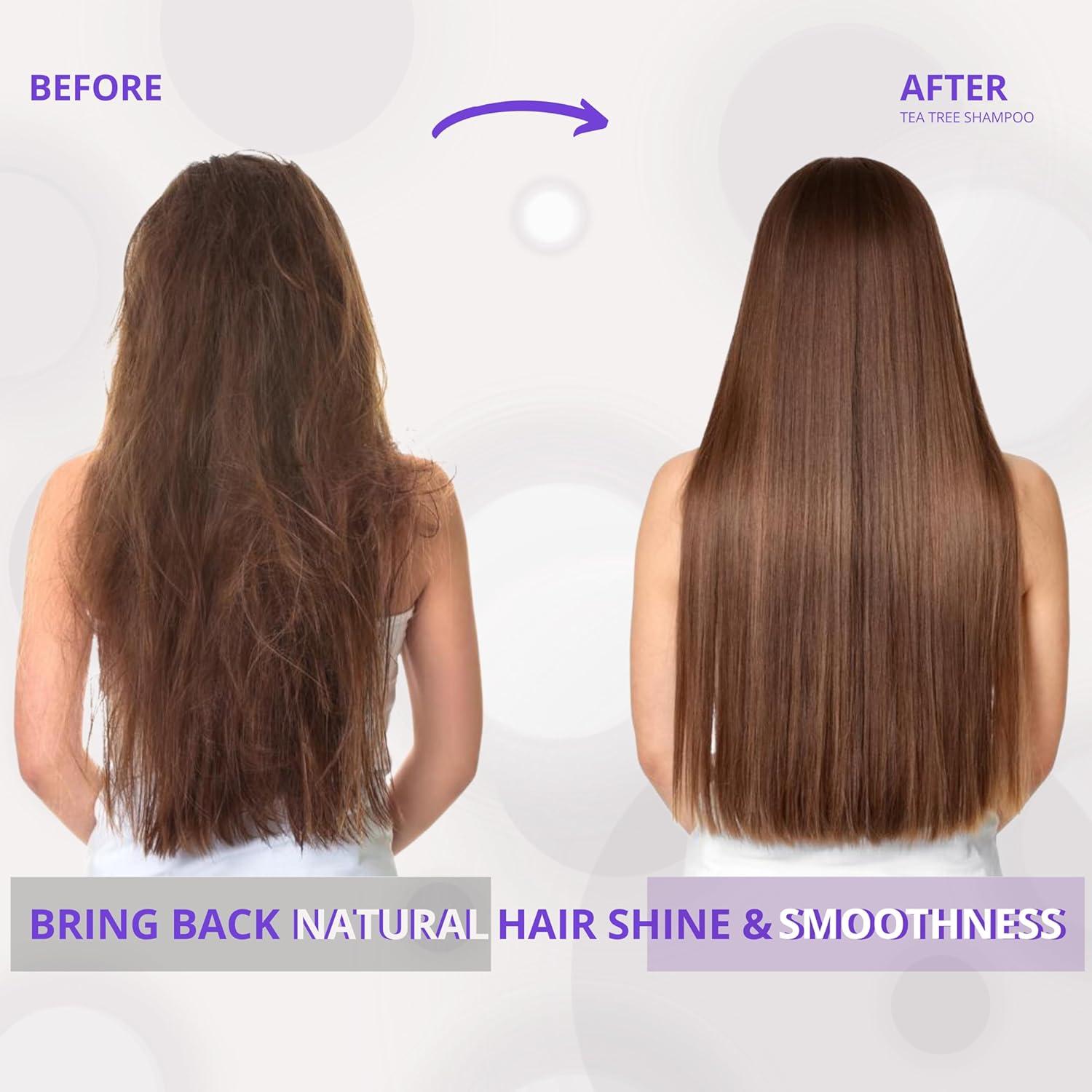 Champú de Árbol de Té Inova Professional 311 ml - Cuidado Nutritivo