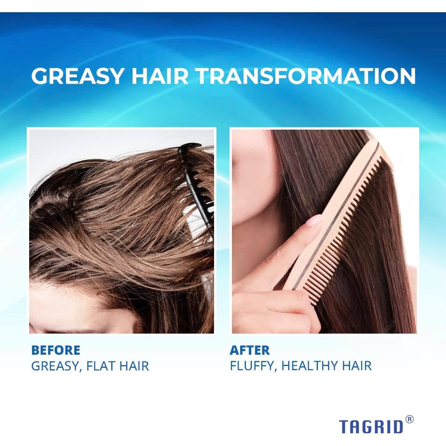 Champú Antifúngico TAGRID 250mL para Psoriasis y Dermatitis