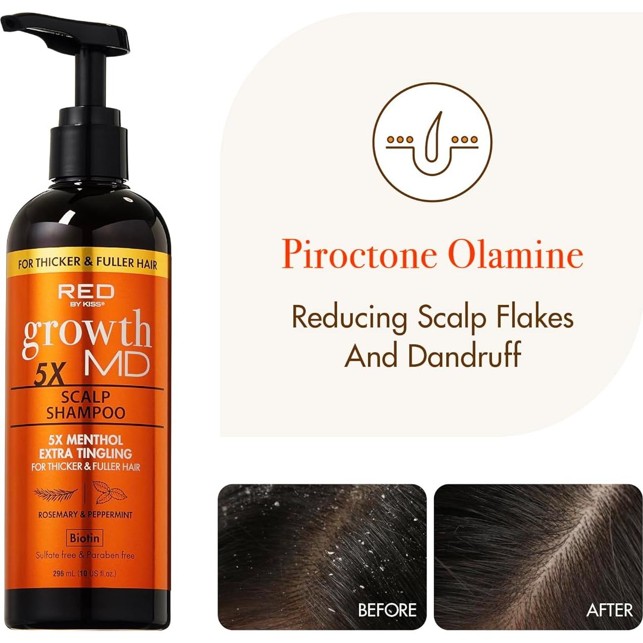 Champú Red by Kiss Growth MD 284g - Mentol Extra Fresco