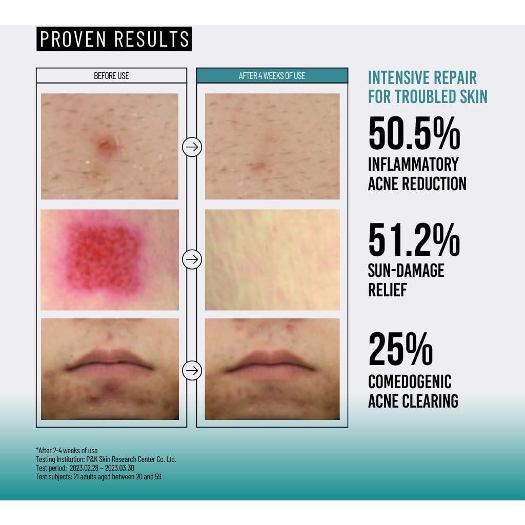 Esencia de Mucina de Caracol JUMISO 95 - Tónico Facial 140 ml