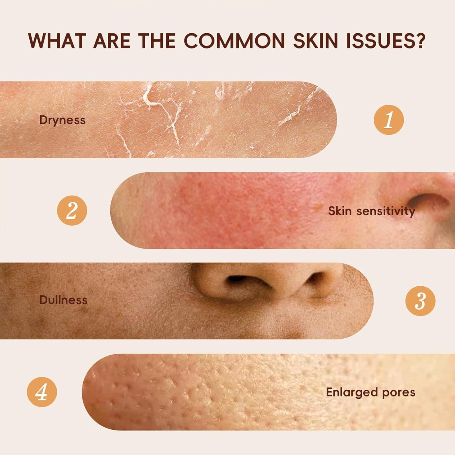 Tónico Hidratante de Arroz YIKESHU 100ml - Piel Radiante