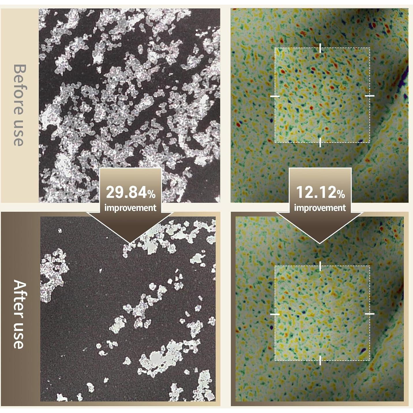 Tónico Exfoliante Ácido Glicólico 7% Benton - Hidratante y Suave