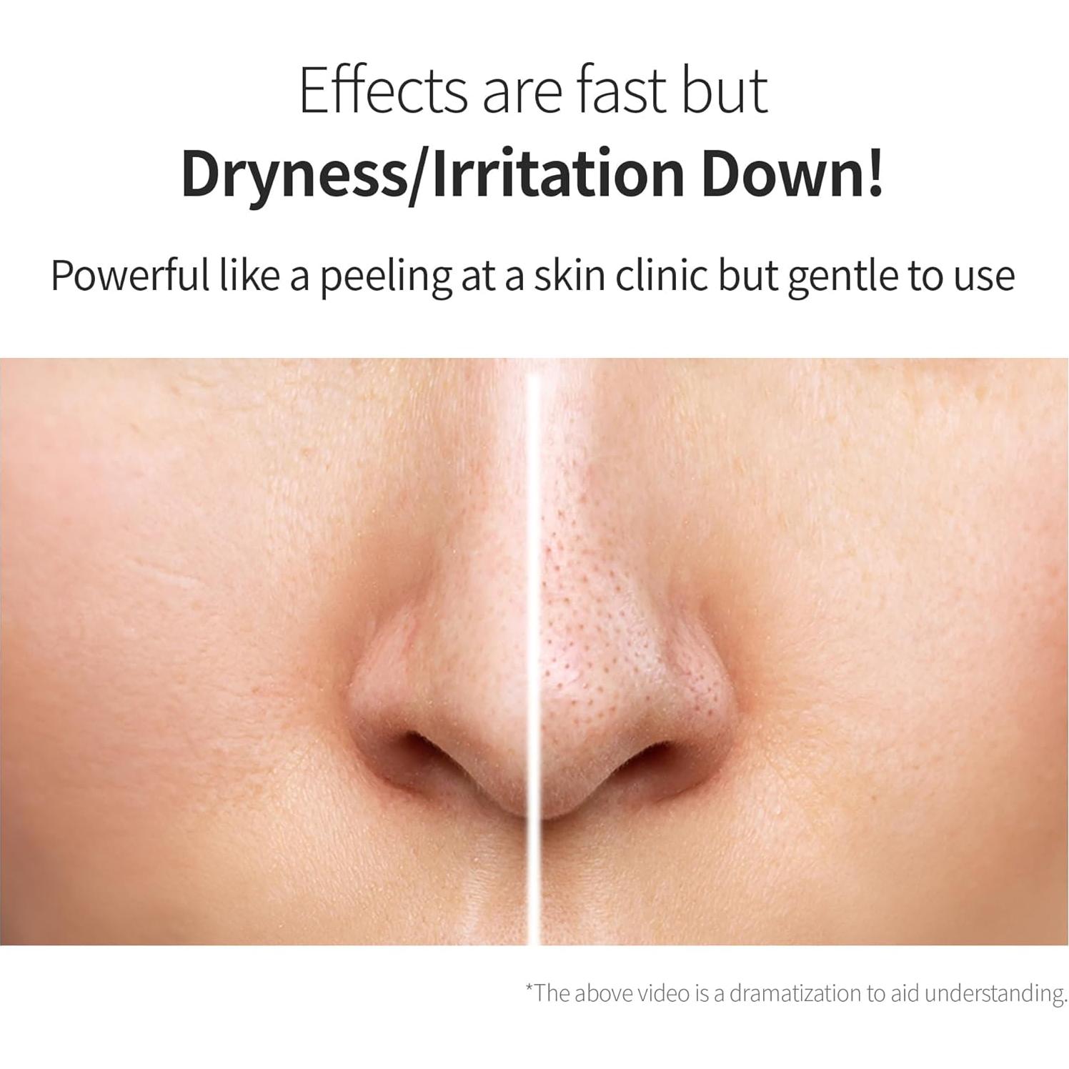 Tónico Exfoliante Ácido Glicólico 7% Benton - Hidratante y Suave