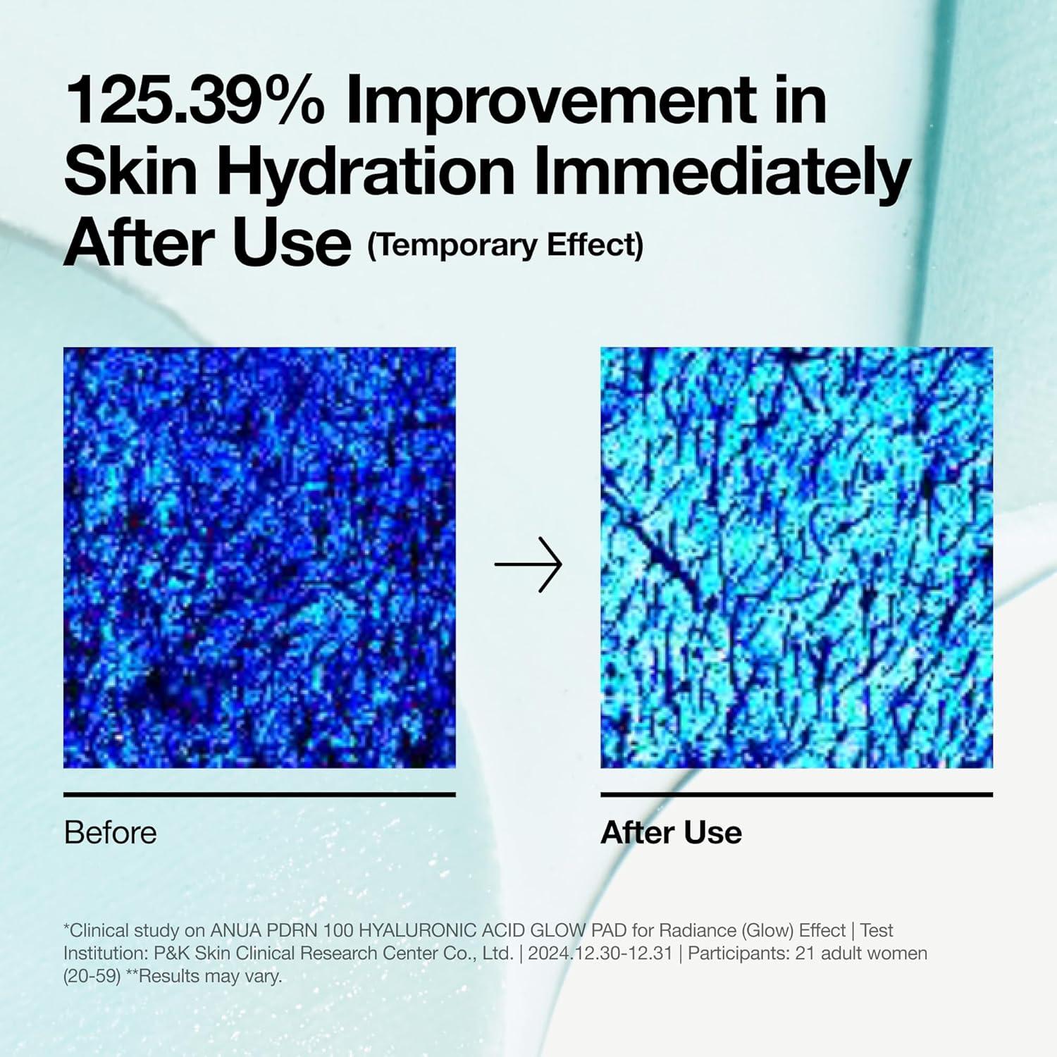 Almohadillas Hidratantes Anua PDRN 180ml - Cuidado Facial Coreano