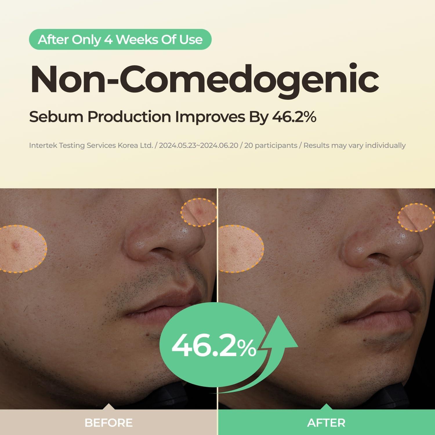 Almohadillas Faciales de Gel de Azufre Wonderwall 70 Unidades