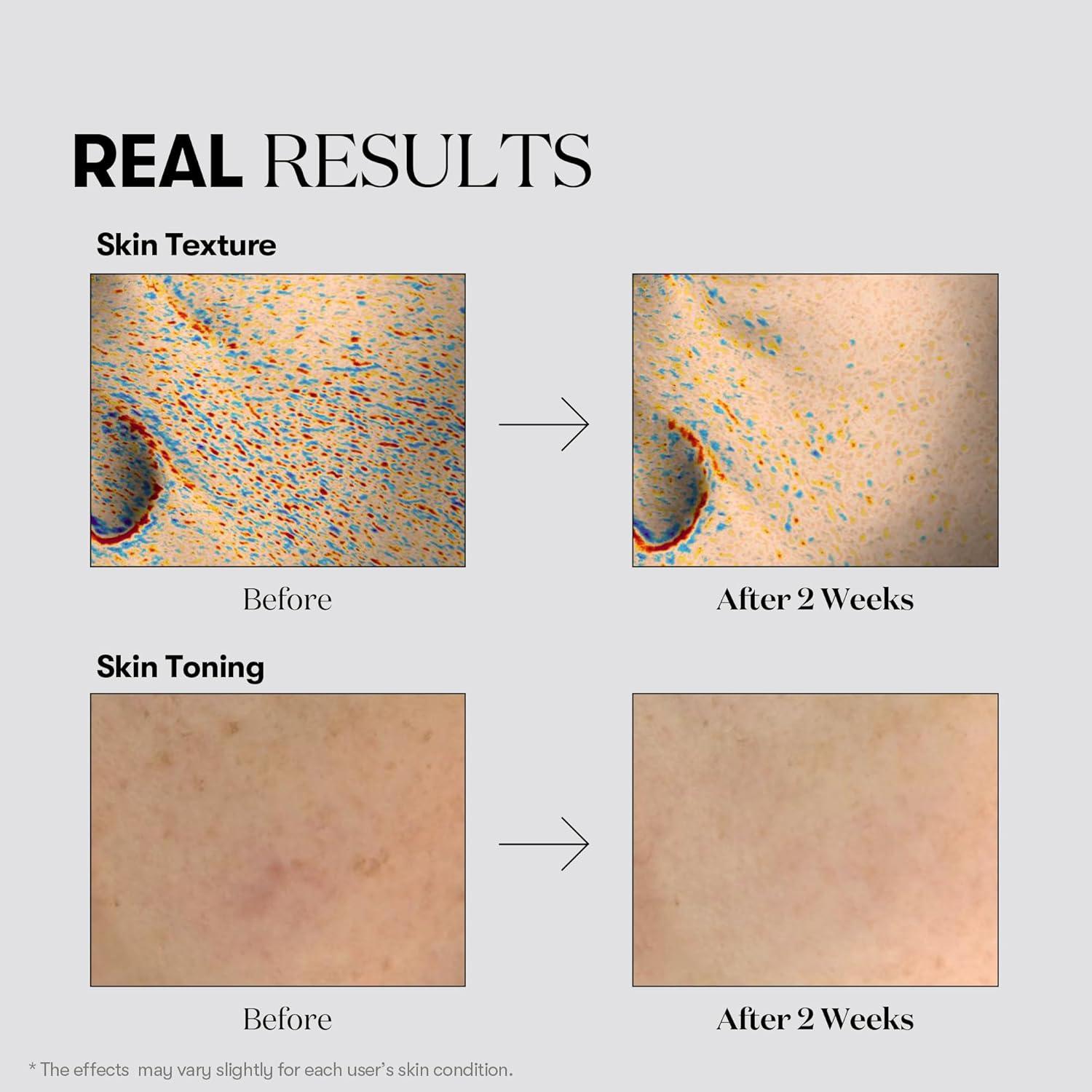 Tónico Facial Aclarante VT COSMETICS 199.5 ml - Ácido Tranexámico, Niacinamida, Hidratante