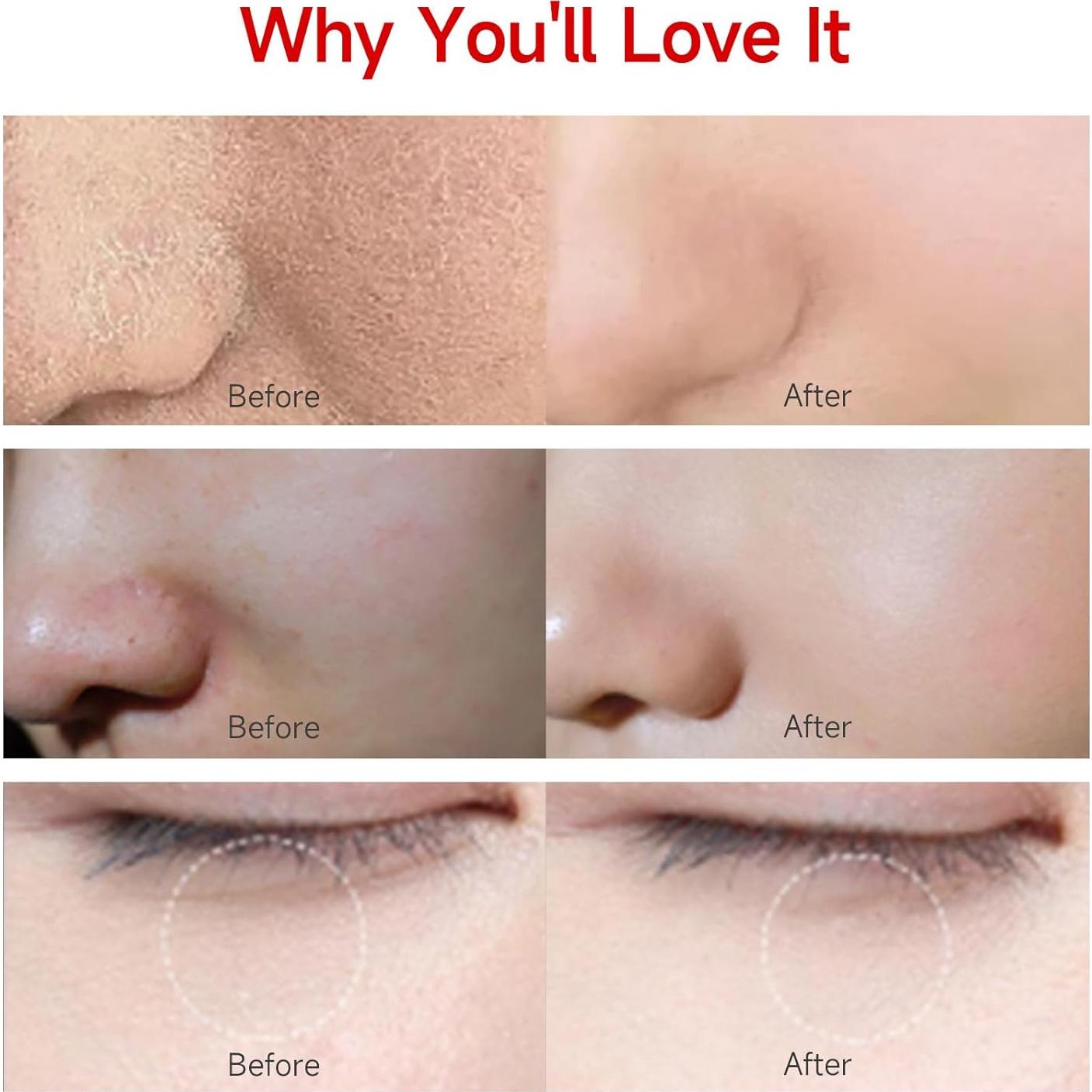 Discos Tonificadores HEALOINE con Ácido Hialurónico - 100 Unidades