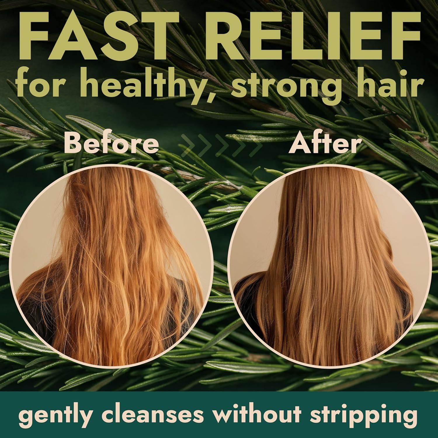 Conjunto de Champú y Acondicionador Terramed 500 ml Alivio Cuero Cabelludo