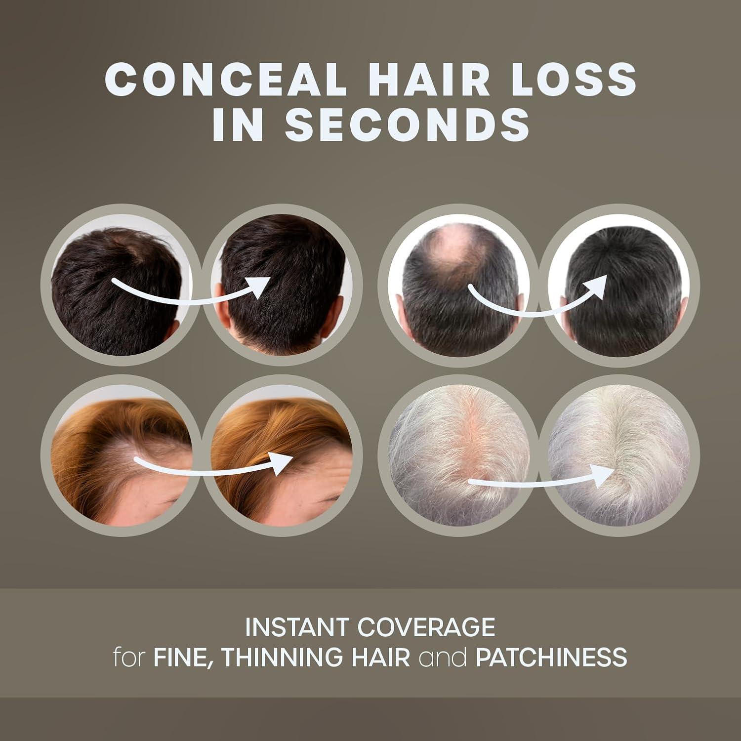 KAAL Polvo de Fibra para Cabello Castaño 27.5g - Efecto Instantáneo