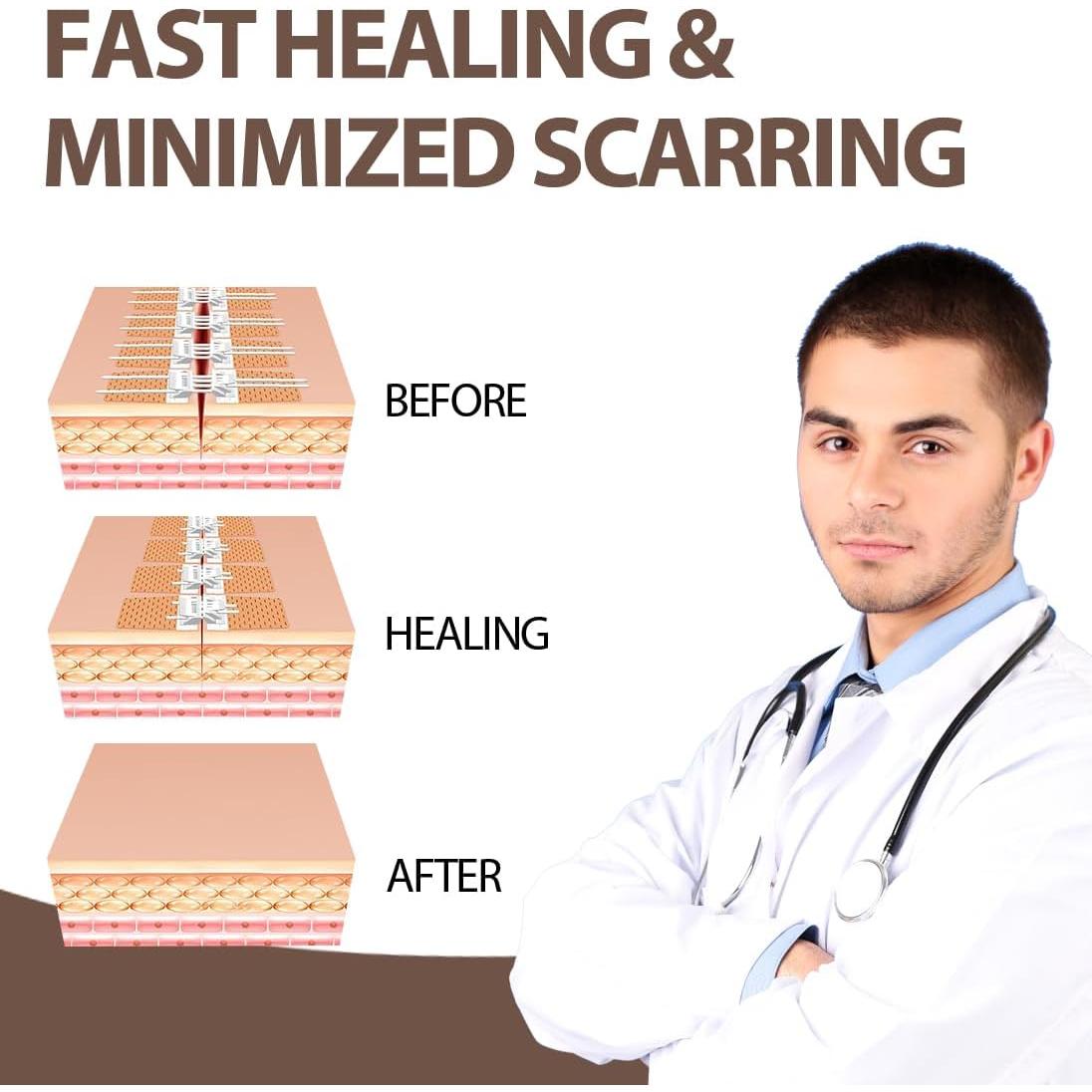 Tiras de Cierre de Heridas CXWLTT 5 Pcs 1.5cm x 8cm