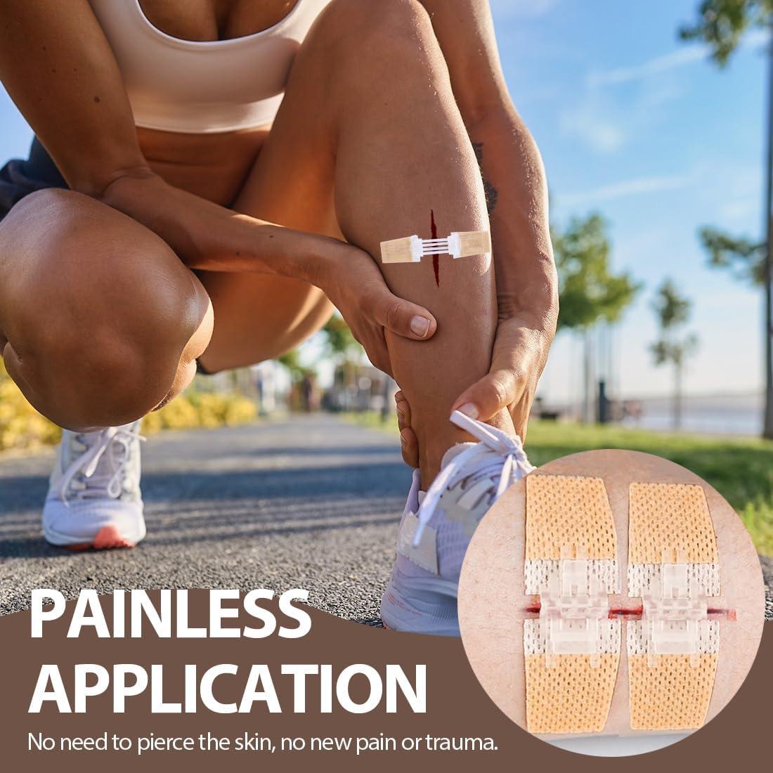 Tiras de Cierre de Heridas CXWLTT 5 Pcs 1.5cm x 8cm