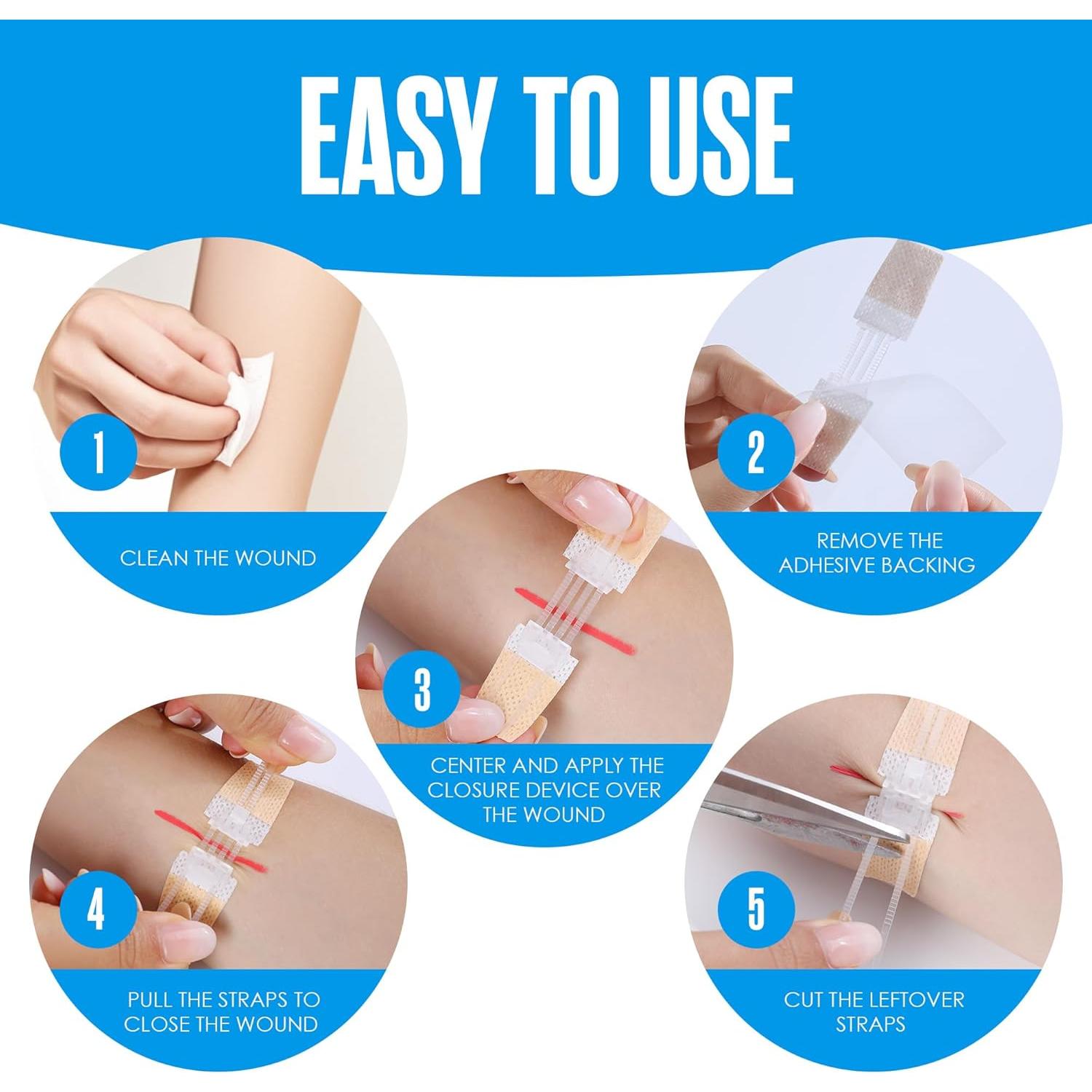 Tiras de Cierre de Heridas Houseables, Kit de 4 Unidades