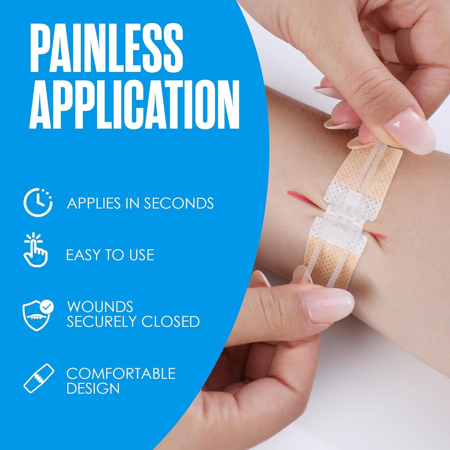 Tiras de Cierre de Heridas Houseables, Kit de 4 Unidades