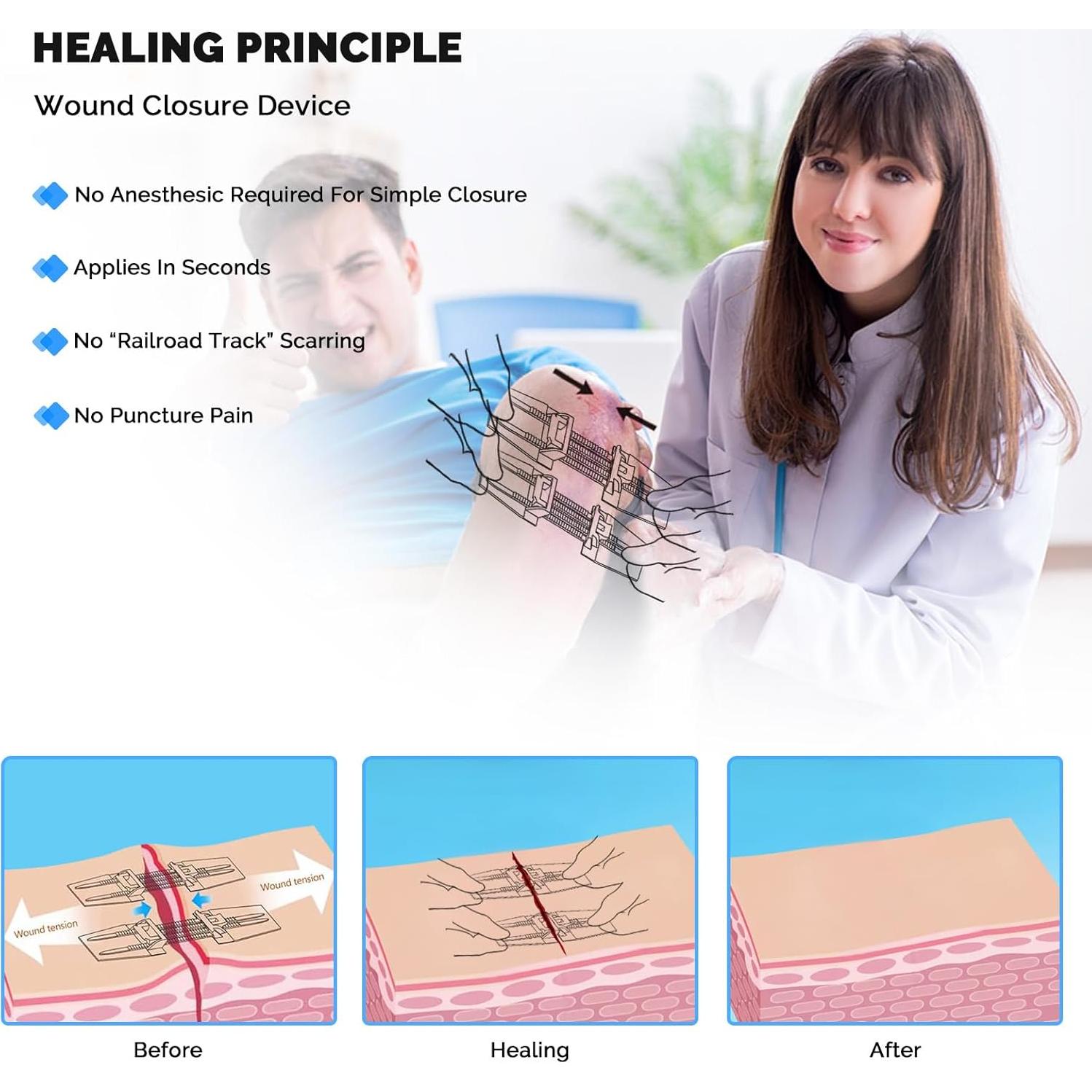 Kit de Cierre de Heridas de Emergencia Greetmed 5 Pcs