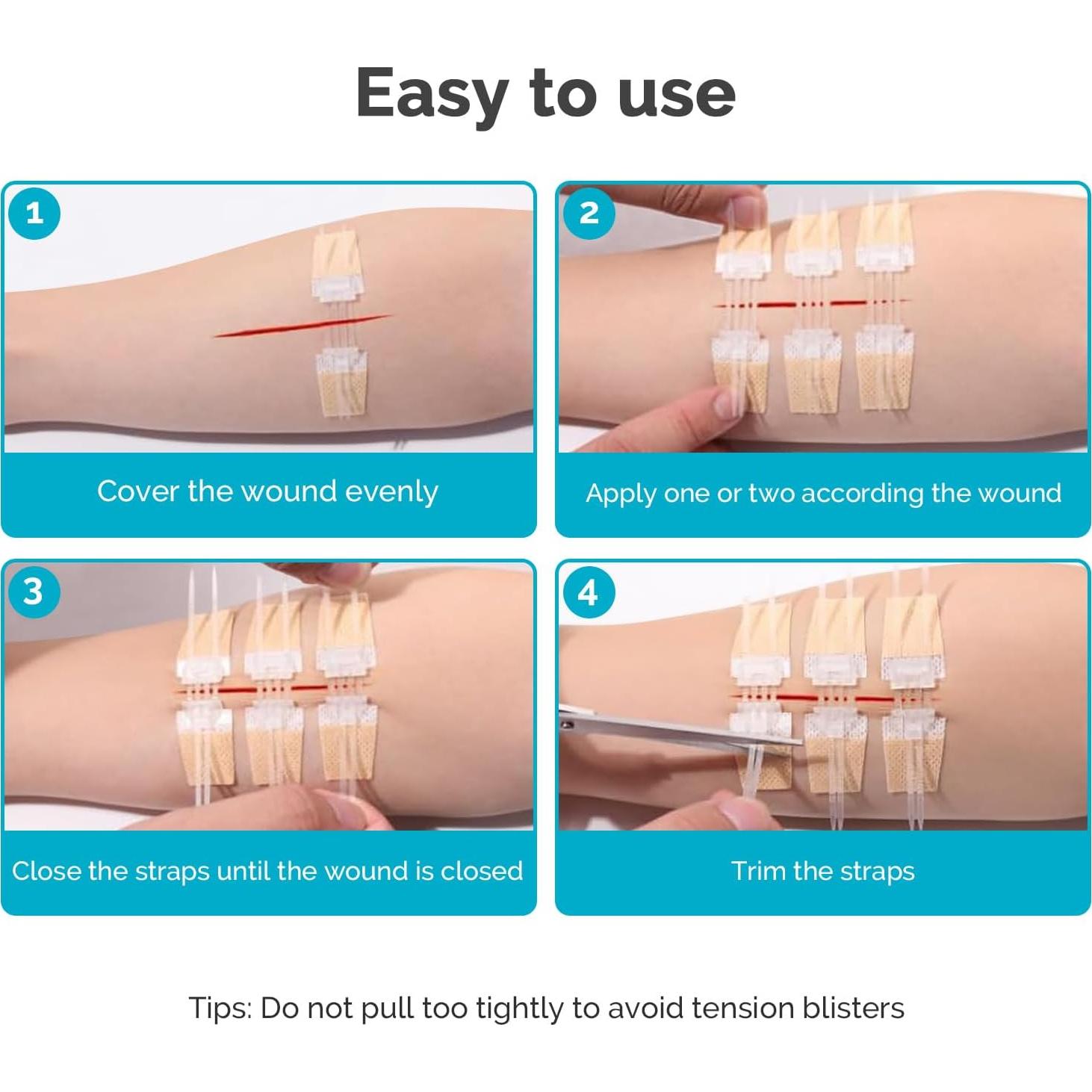 Kit de Cierre de Heridas de Emergencia Greetmed 5 Pcs