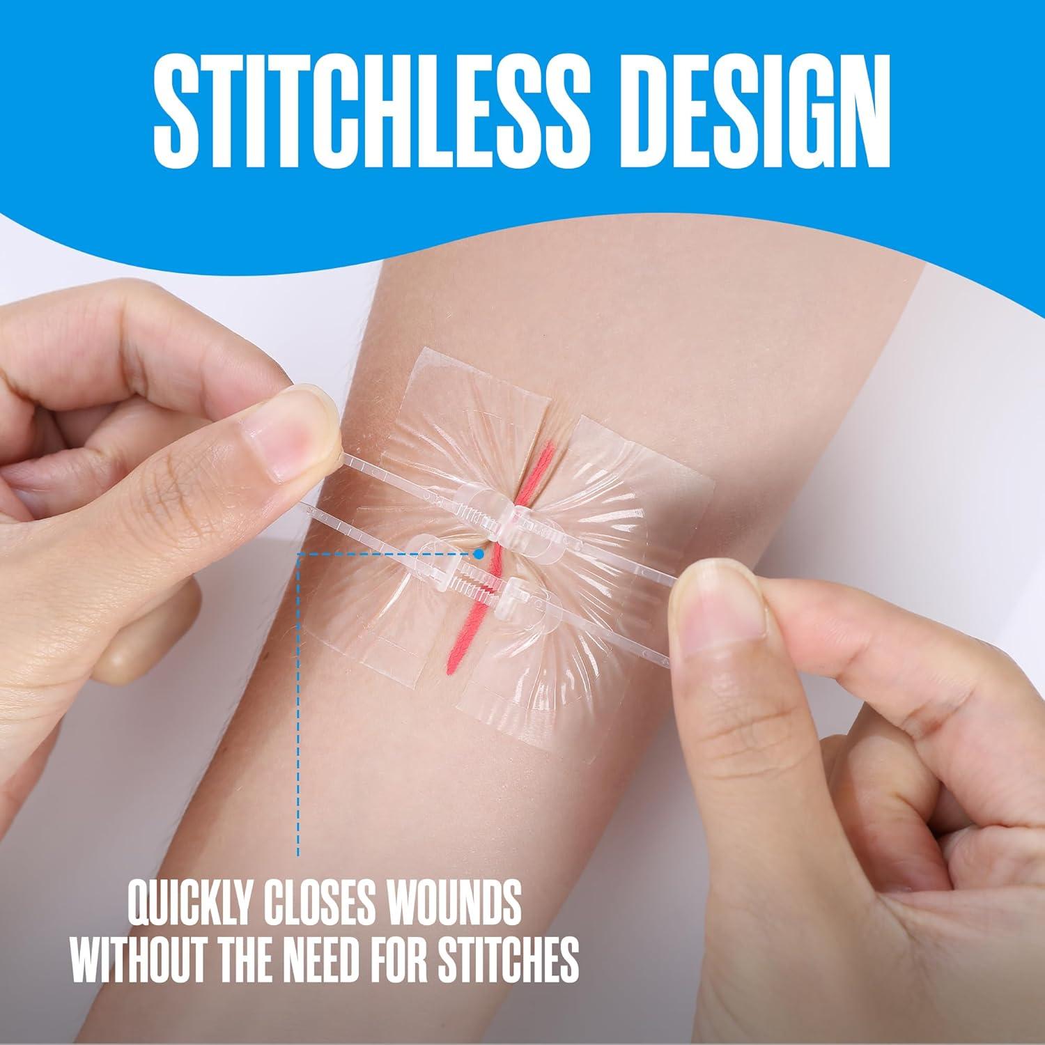 Tiras de Cierre de Heridas Houseables, Kit de 4 Puntos de Mariposa