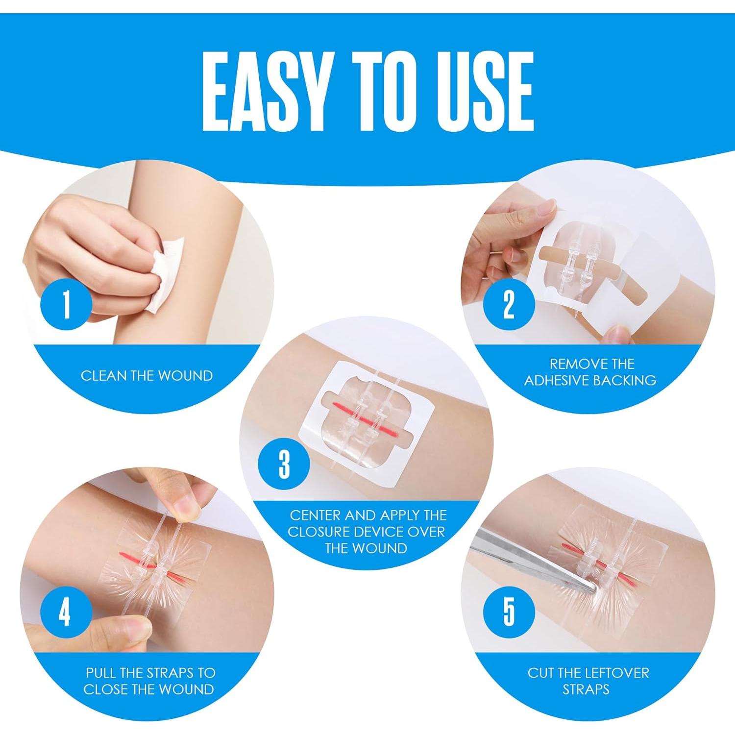 Tiras de Cierre de Heridas Houseables, Kit de 4 Puntos de Mariposa