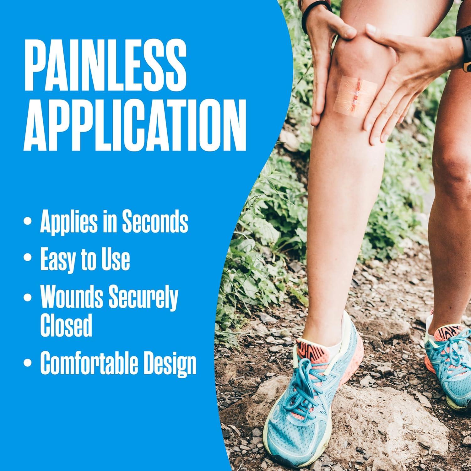 Tiras de Cierre de Heridas Houseables, Kit de 4 Puntos de Mariposa