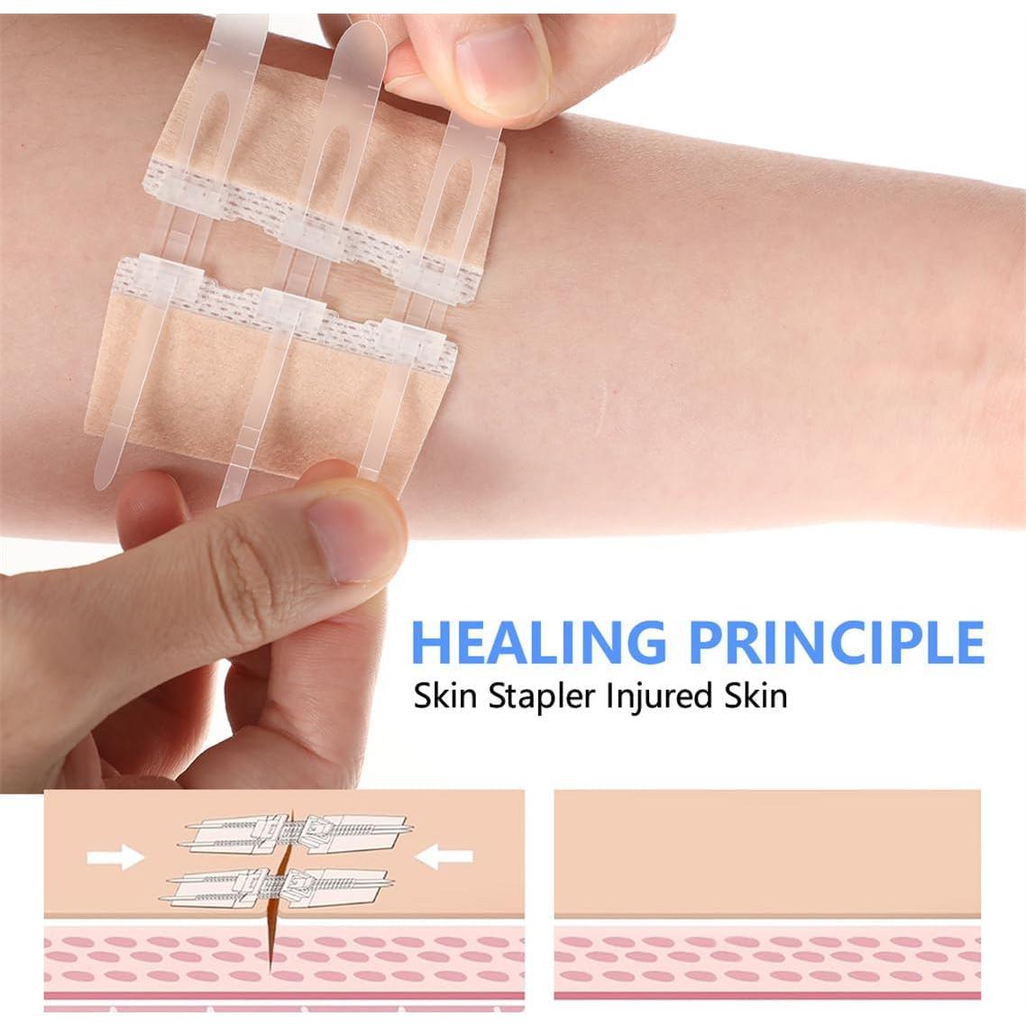 Tiras de Cierre de Heridas CXWZRU Kit de Primeros Auxilios