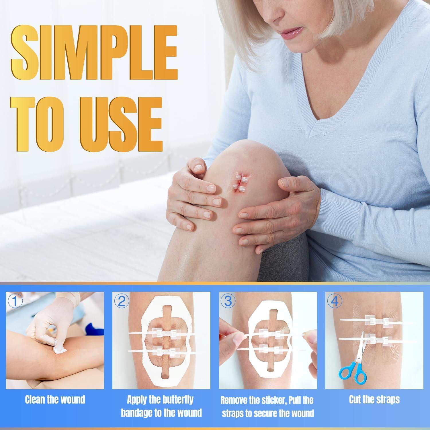 6 Vendajes Mariposa Hons para Cierre Rápido de Heridas