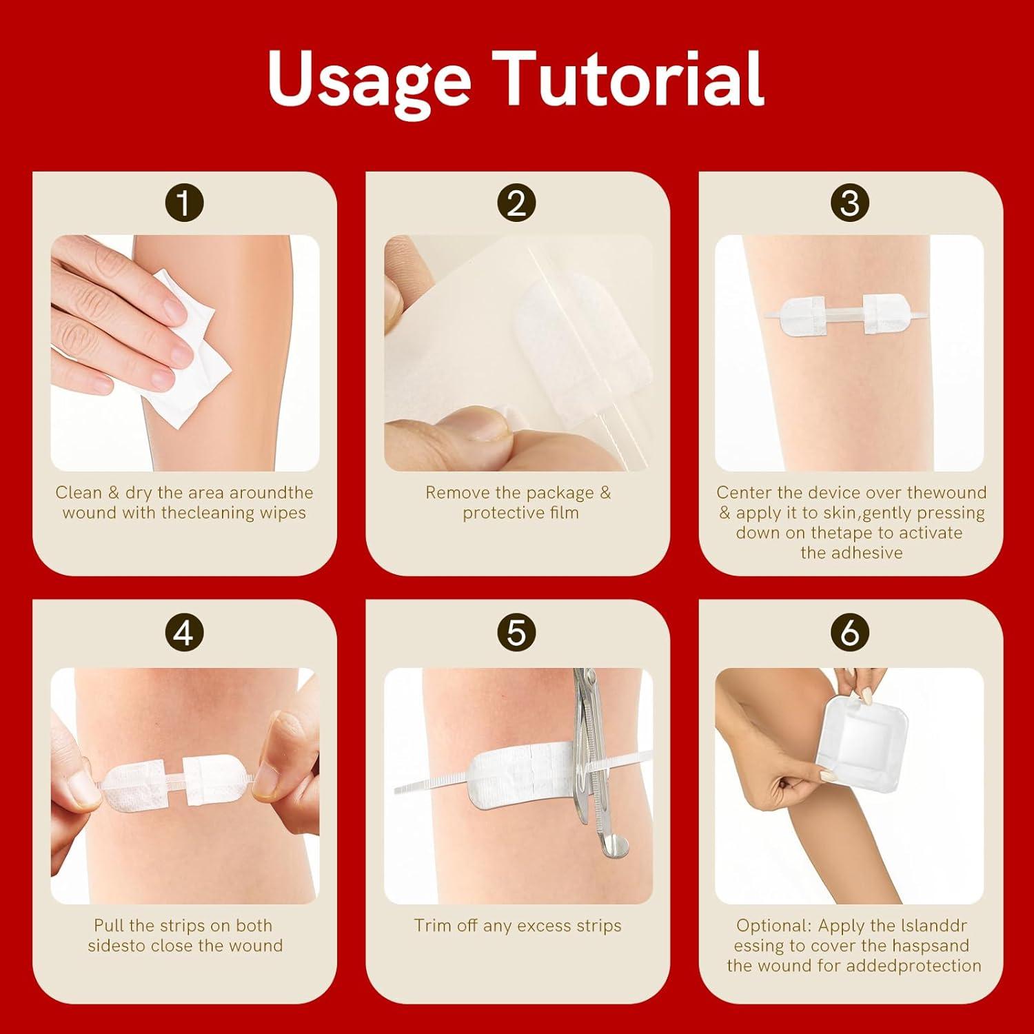 Kit de Cierre de Heridas AISIMEE - 6 Tiras Impermeables Sin Suturas