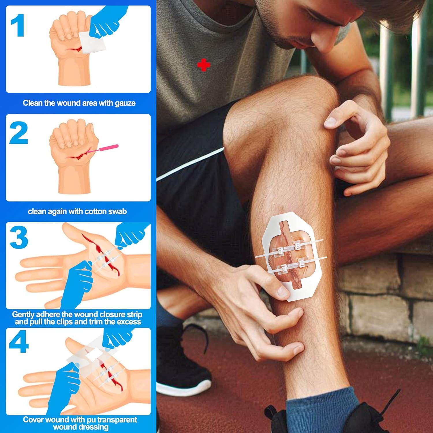 Kit de Cierre de Heridas baMark - 12 Piezas para Primeros Auxilios