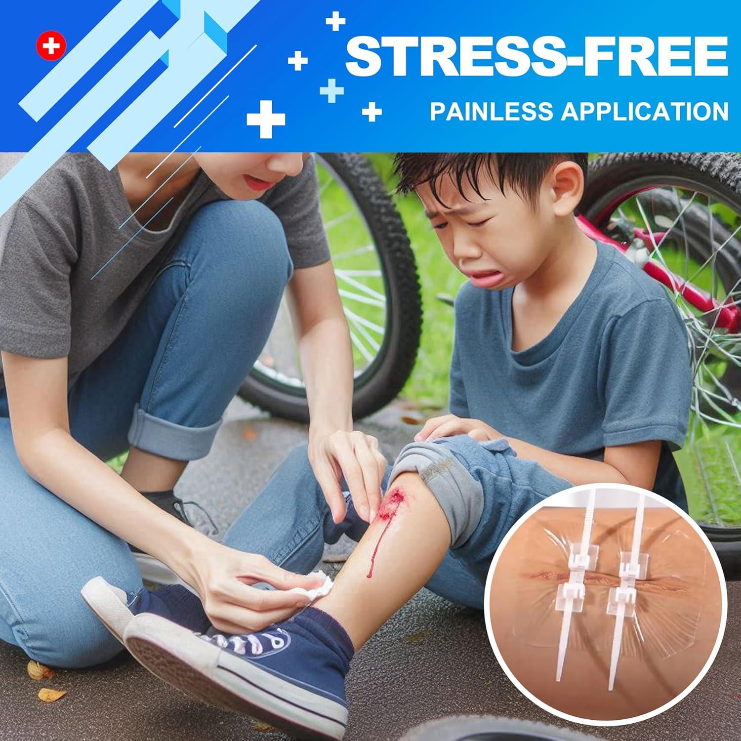 Kit de Cierre de Heridas baMark - 12 Piezas para Primeros Auxilios