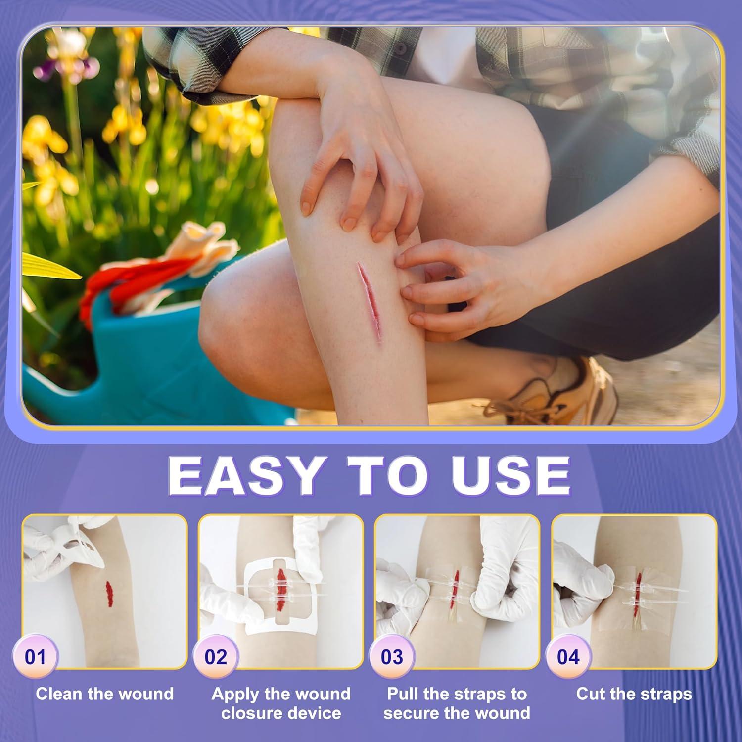 Kit de Cierre de Heridas Mariposa SYNTHGENE 4 Pcs 6.0-7.1cm