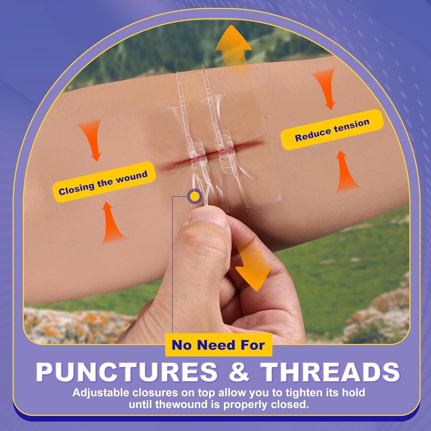 Kit de Cierre de Heridas Mariposa SYNTHGENE 4 Pcs 6.0-7.1cm