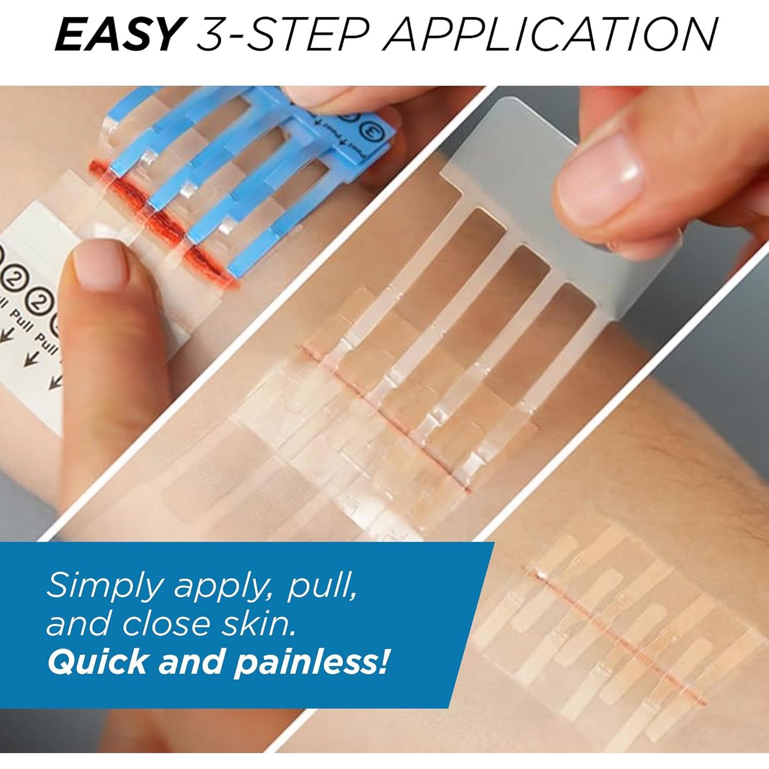 Kit de Laceración Clozex - Cierre de Piel 3.81 cm Estéril