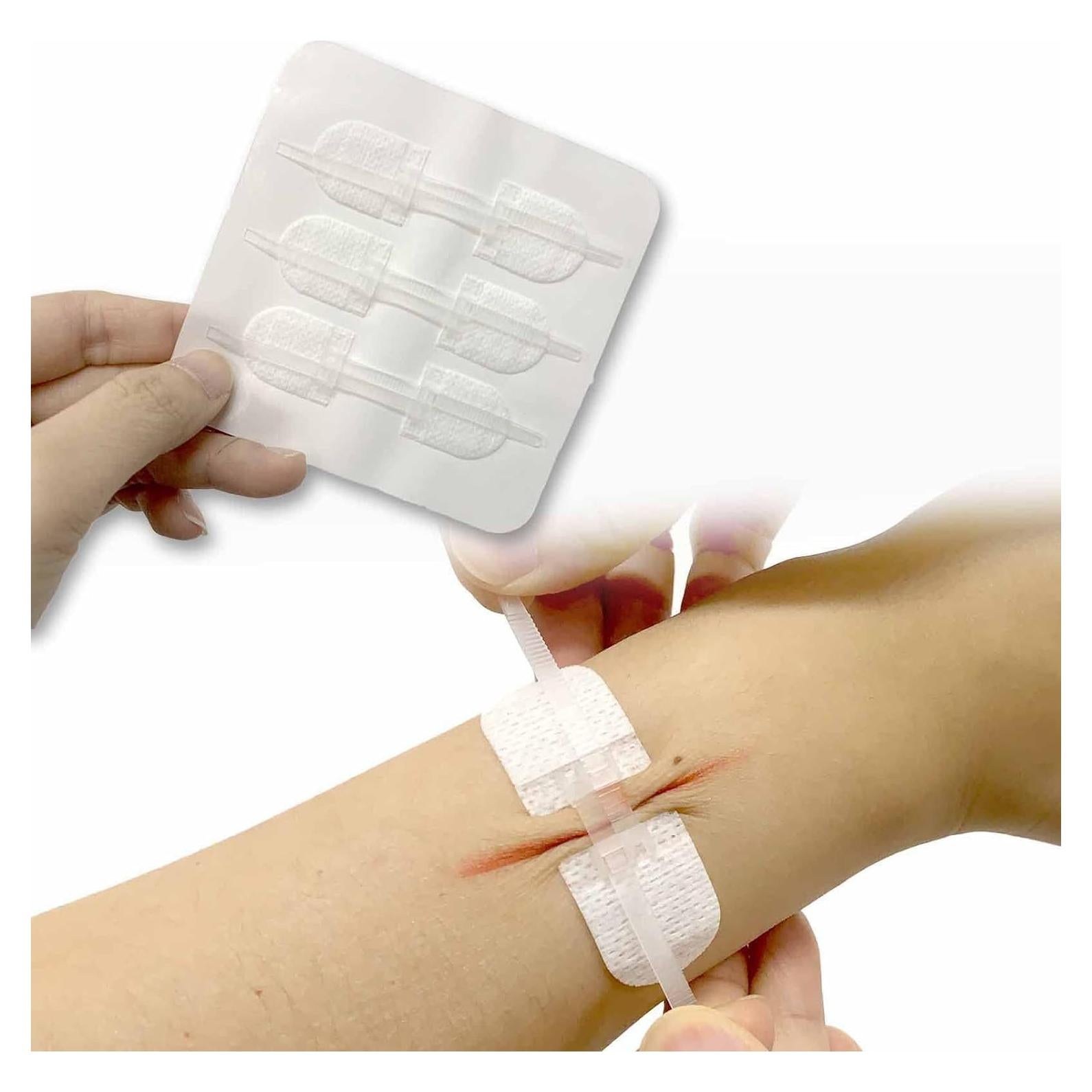 Kit de Cierre de Heridas Zip Stitch Sofarefinish - 6 Piezas