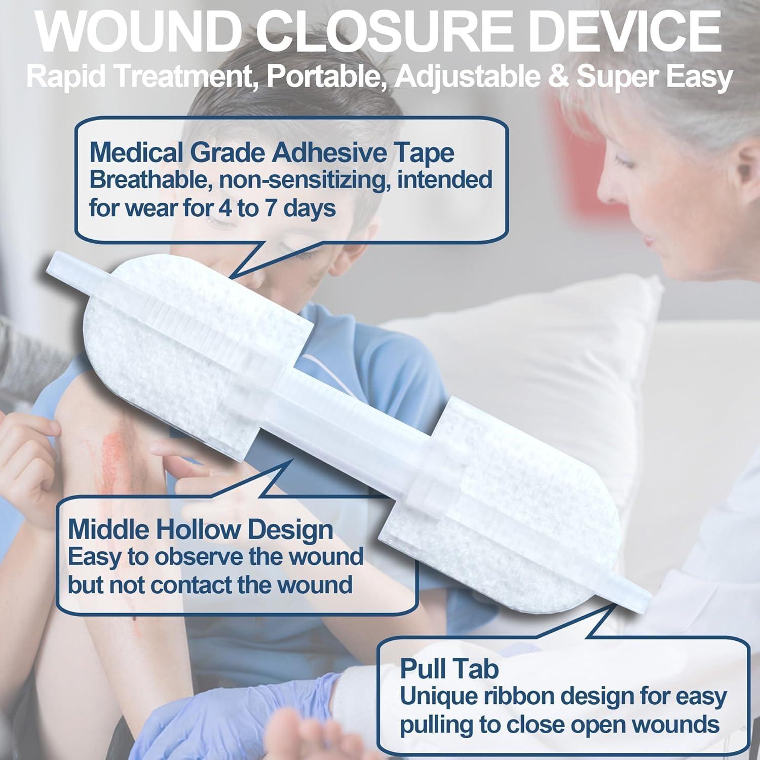 Kit de Cierre de Heridas Zip Stitch Sofarefinish - 6 Piezas