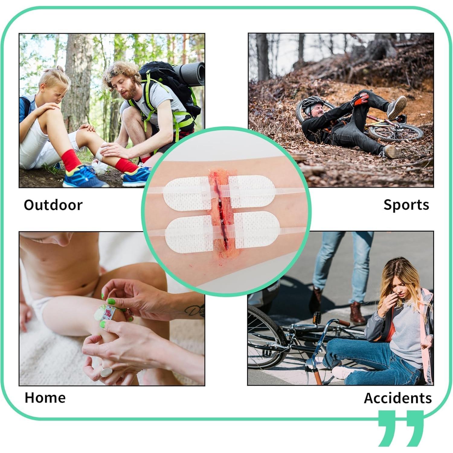 Kit de Cierre de Heridas Zip Stitch Sofarefinish - 6 Piezas