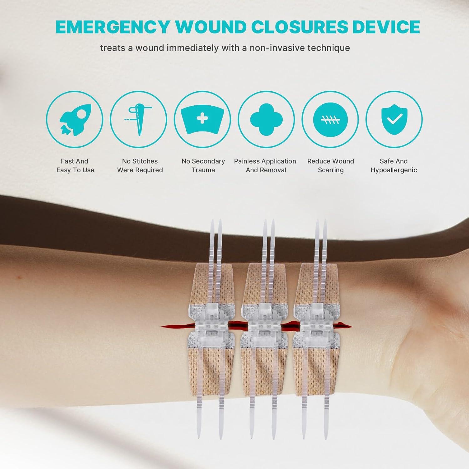 Tiras de Cierre de Heridas NETWALL 10 Pcs 8x2 cm