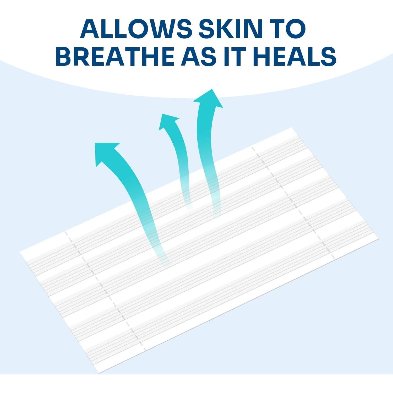 Cierre de Heridas Conkote - 40 Tiras Transpirables 15.6x8.0 cm