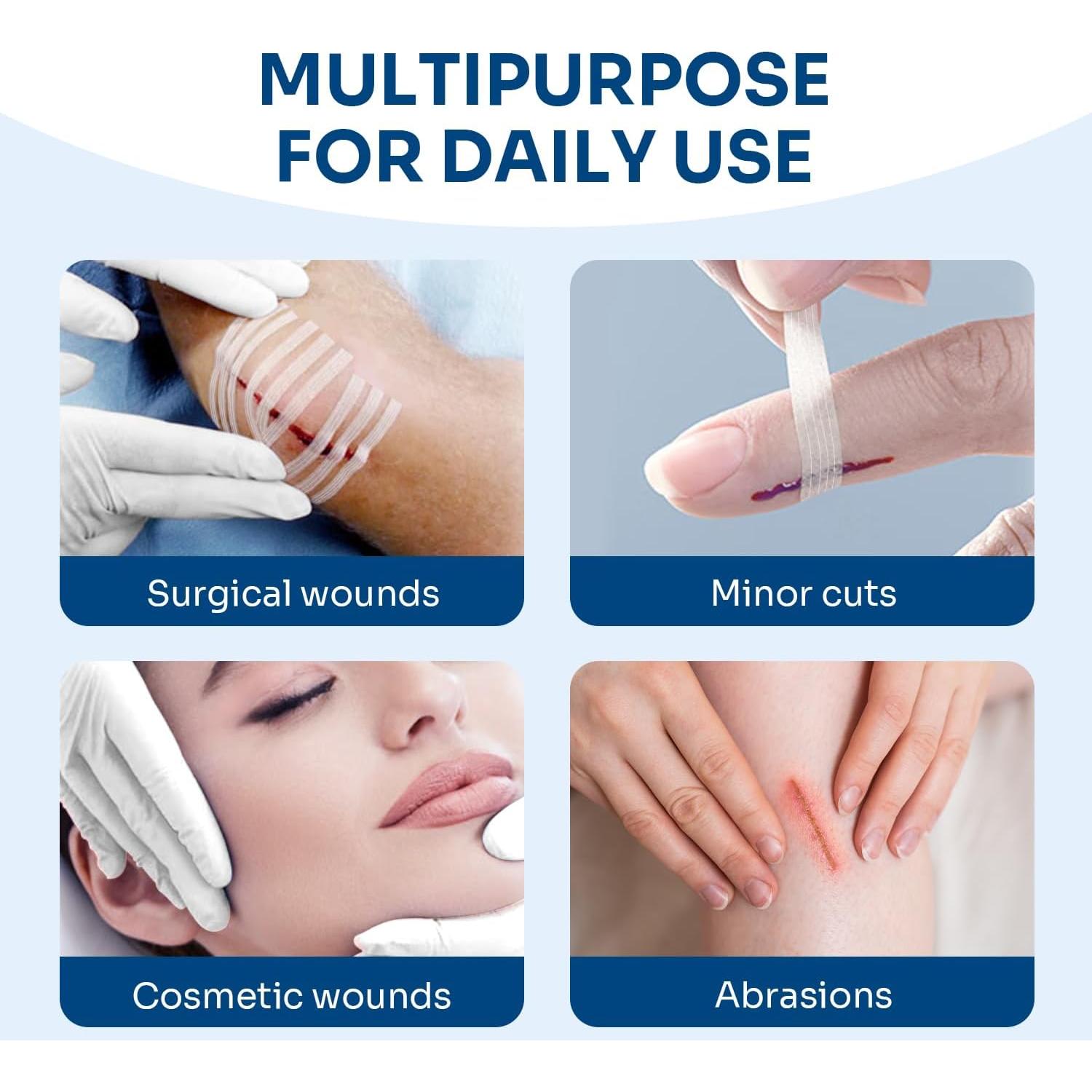 Cierre de Heridas Conkote - 40 Tiras Transpirables 15.6x8.0 cm