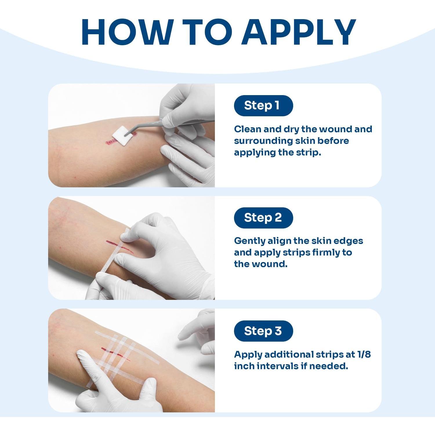 Cierre de Heridas Conkote - 40 Tiras Transpirables 15.6x8.0 cm